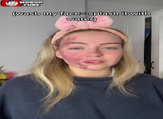Video :She records her skin condition as it slowly spreads across her face
